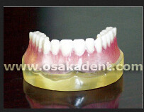 Modelo de ensino de forma dentária de implantes dentários