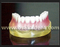 Modelo de ensino de forma dentária de implantes dentários