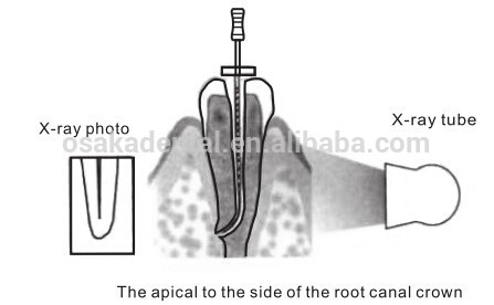 Localizador dental do ápice da precisão alta OSAKA para o ápice da raiz