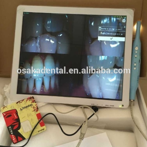 Monitor 17inch branco + câmera intraoral dental com suporte do monitor VGA + VIDEO + US B +