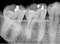 Fixado na parede dental com a máquina aprovada do raio X do CE