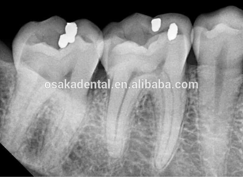 Fixado na parede dental com a máquina aprovada do raio X do CE