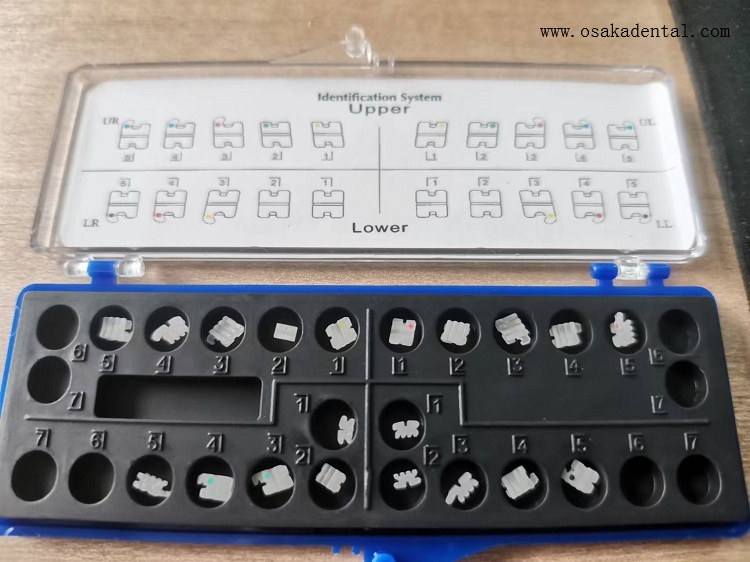 陶瓷 托槽 2022 1