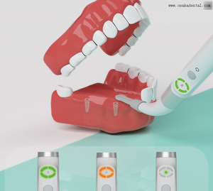Detector de implante localizador de implante dentário para localizar os parafusos do implante