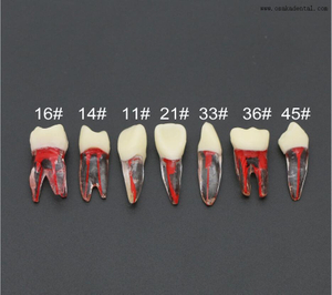 Modelo de dentes de resina para prática de ensino de estudantes de dentista