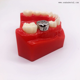 Dental Ortodôntico em Aço Inoxidável Coroa Infantil OSA-P30