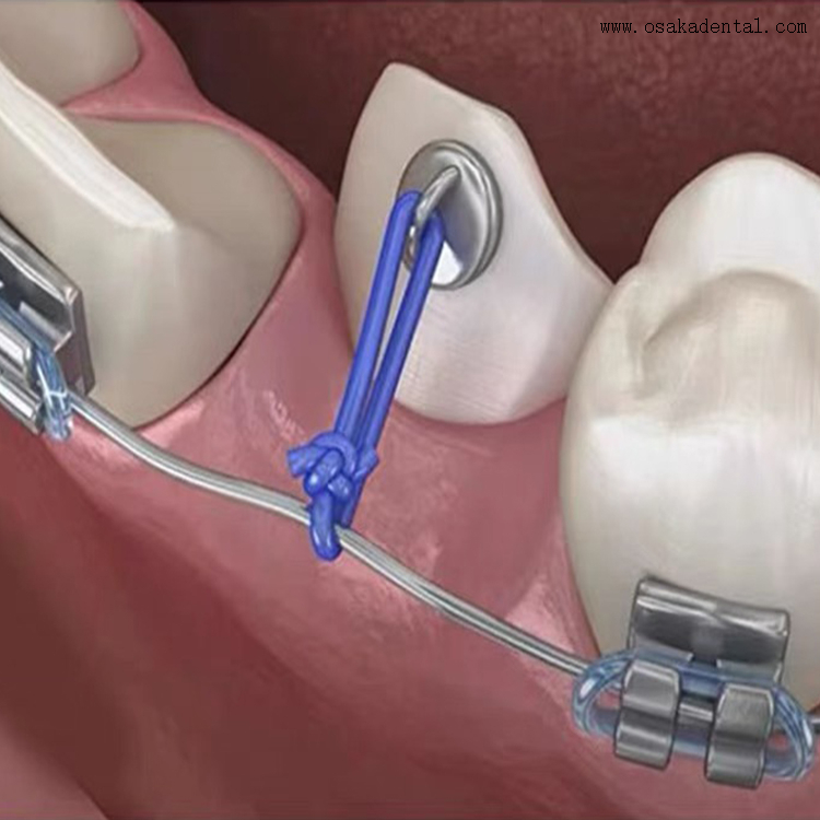 Linha ortodôntica dental do poder dos acessórios ortodônticos dentais 25ft 