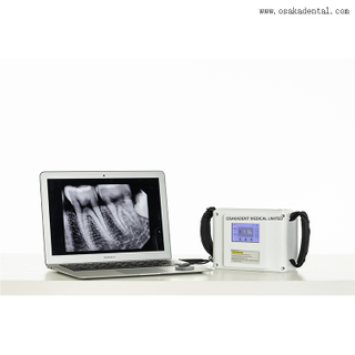 Equipamento Dental Dental Portable X Ray Unidade