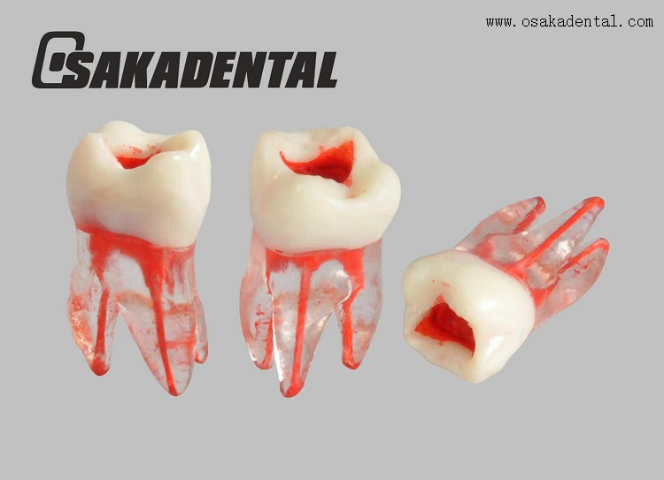 Molde para estudo dos dentes do canal radicular dentário