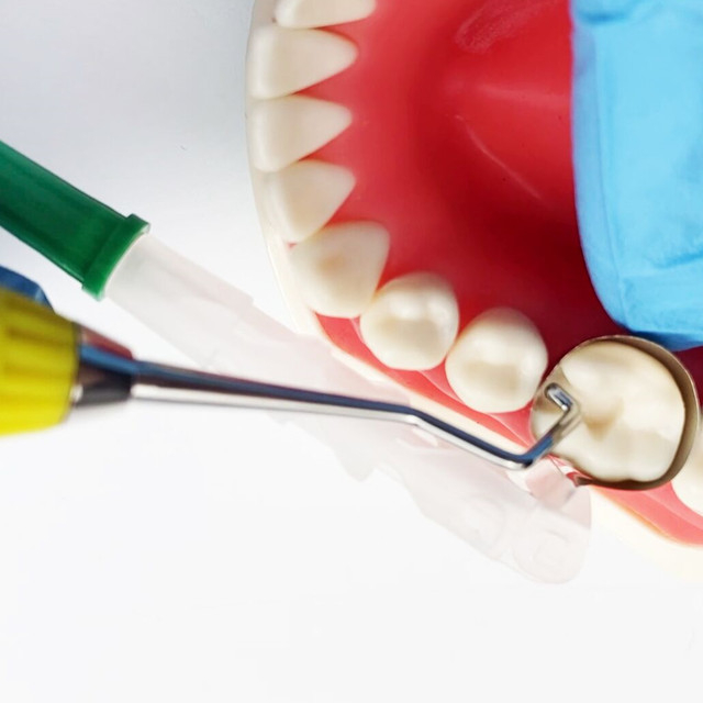 Novo retentor e matriz sem asas dentárias descartáveis