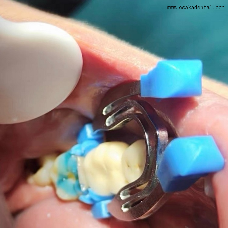 QQ foto 20240531105310