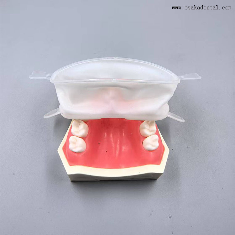 Abridor de boca completo consumível odontológico de alta qualidade