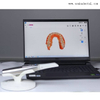 Scanner intraoral odontológico Modelo 3D