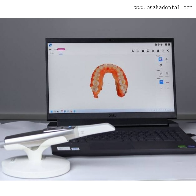 Scanner intraoral odontológico Modelo 3D