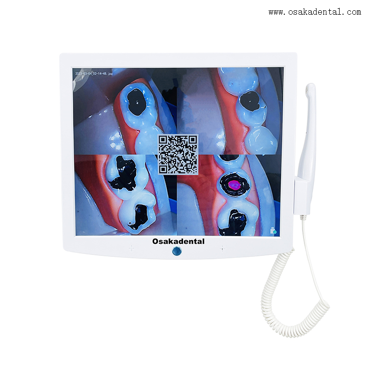 Monitor de cadeira odontológica com câmera oral