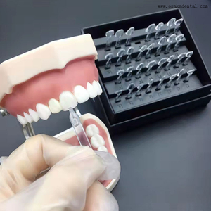 Ueneer Dental Veneer Tool torna a arte dentária simples