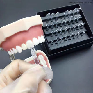 Ueneer Dental Veneer Tool torna a arte dentária simples