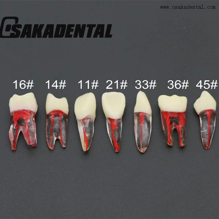 Molde para estudo dos dentes do canal radicular dentário
