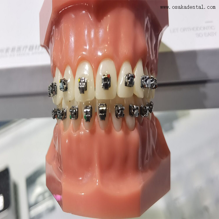 Braquete de metal autoligado dental para ortodontia dental