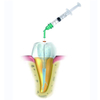 Sistema de Endoirrigação por Pressão Negativa Dentária