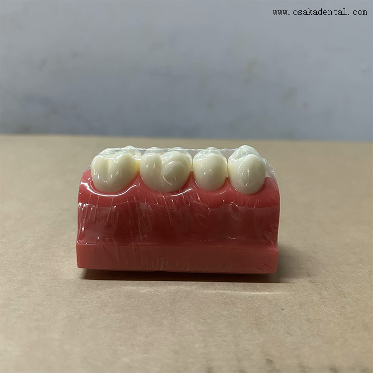 Modelo de demonstração de selante dentário para fossas e fissuras 