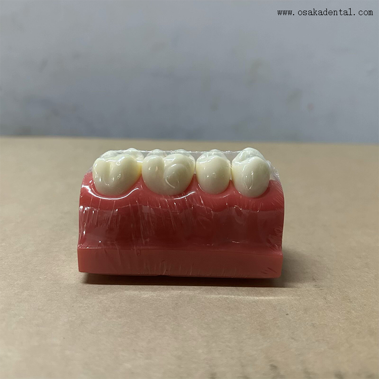 Modelo de demonstração de selante dentário para fossas e fissuras 
