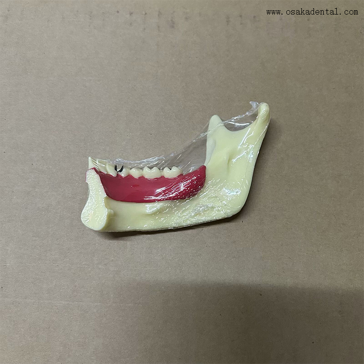 Modelo de dentes de decomposição mandibular dentária 