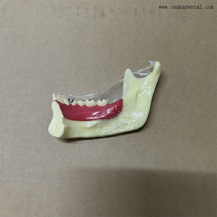 Modelo de dentes de decomposição mandibular dentária 