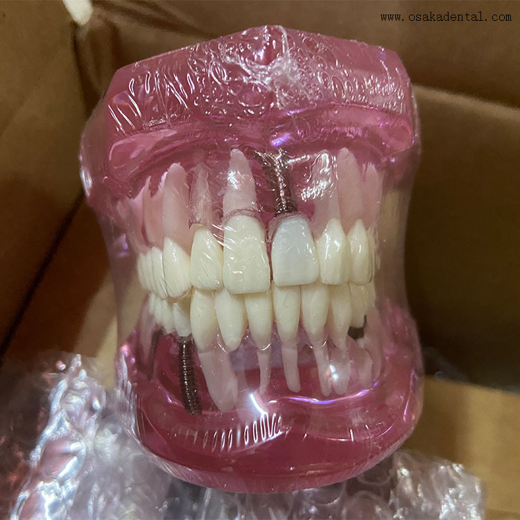 Modelo de implante dentário para ensino de dentista