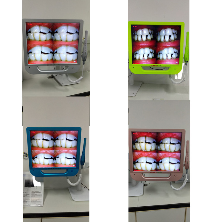 Uma Câmera Intraoral Dental Colorida de 17 polegadas com VGA e VÍDEO e USB e WIFI, incluindo suporte para monitor